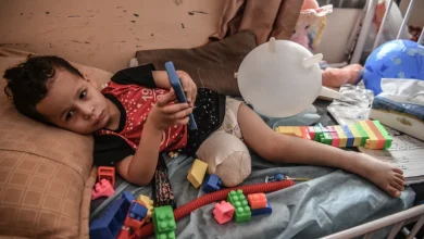 تصريح مروع عن غزة.. 10 أطفال يفقدون ساقاً أو ساقين يومياً