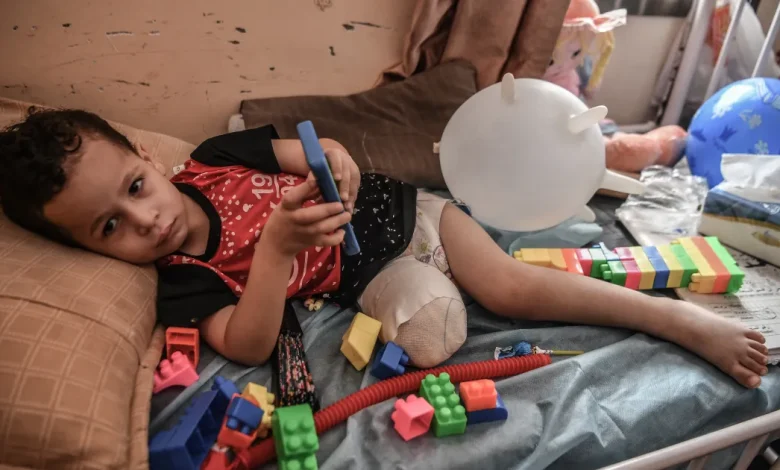 تصريح مروع عن غزة.. 10 أطفال يفقدون ساقاً أو ساقين يومياً