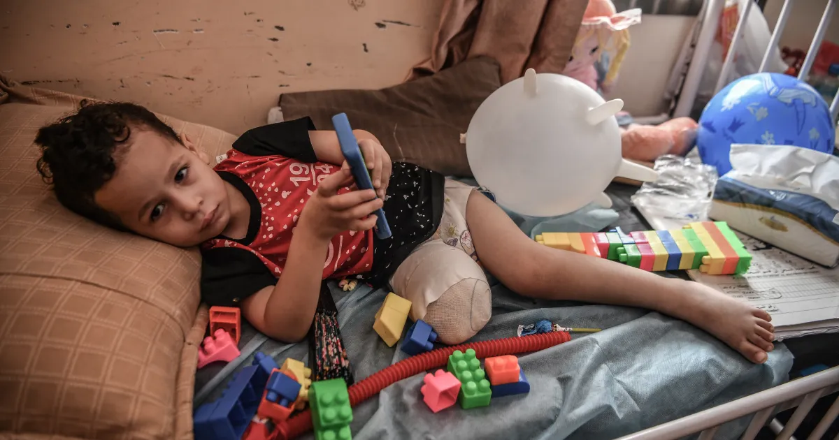 تصريح مروع عن غزة.. 10 أطفال يفقدون ساقاً أو ساقين يومياً